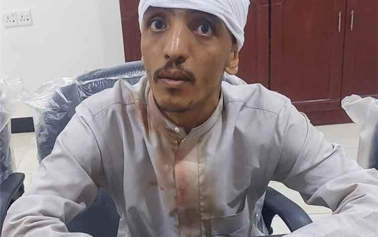 أصيل السقلدي: التحقيقات تكشف هوية المعتدى عليه في أحداث ساحة العروض وتنفي عمله مع أي قناة فضائية