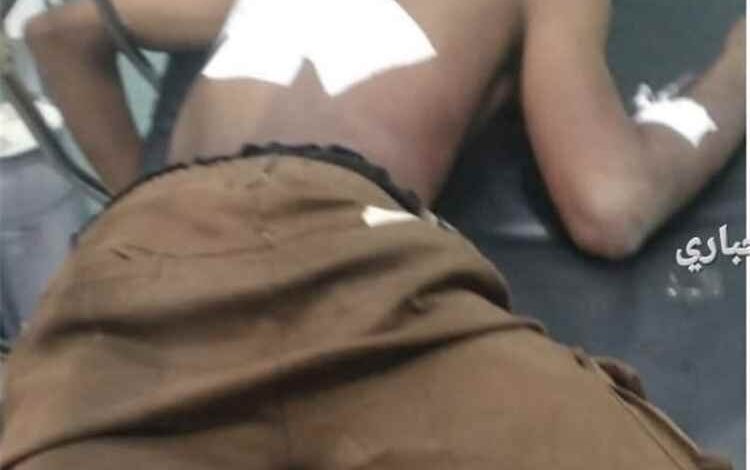 المليشيات الحوثية تستهدف بقذائف الهاون الأعيان المدنية شمال الضالع وسقوط ضحايا واضرارًا بالممتلكات