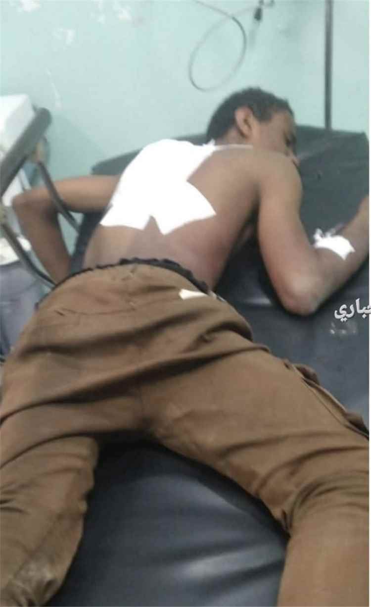 المليشيات الحوثية تستهدف بقذائف الهاون الأعيان المدنية شمال الضالع وسقوط ضحايا واضرارًا بالممتلكات