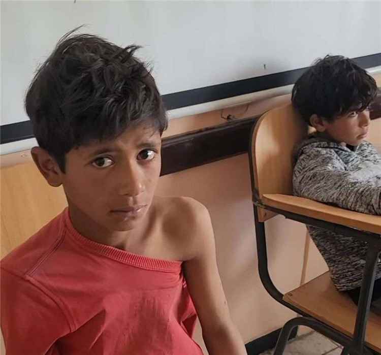 تعز .. تسجيل أربع إصابات جديدة بعضات كلاب بعد وفاة طفل