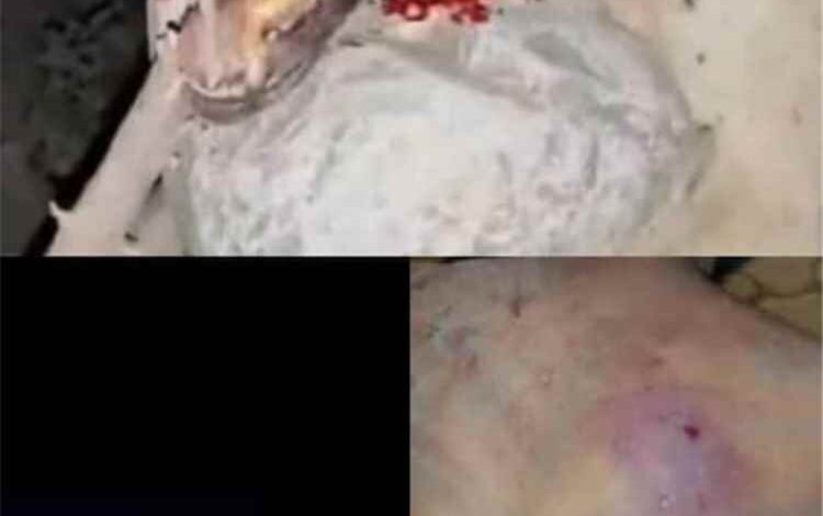 حيوان مفترس يهاجم المواطنين في عسد الجبل بحضرموت ويوقع 12 اصابة بينهم نساء واطفال (صورة)