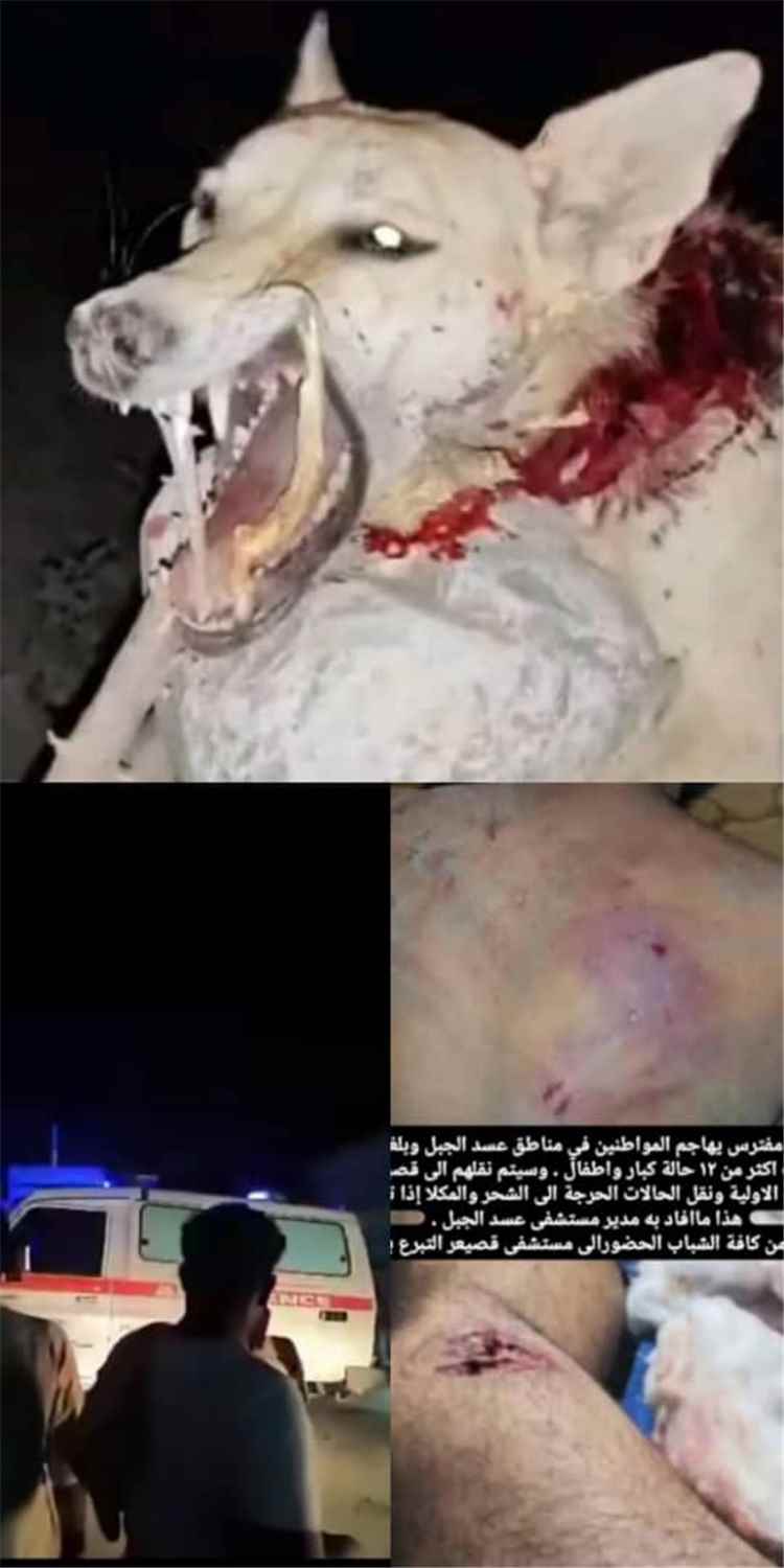 حيوان مفترس يهاجم المواطنين في عسد الجبل بحضرموت ويوقع 12 اصابة بينهم نساء واطفال (صورة)