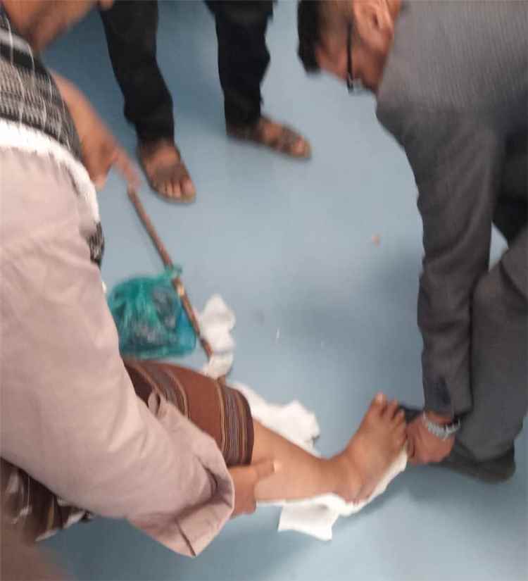 طوابير أمام عيادة العظام بمستشفى رصد العام.. واستضافة ريدان العمري تخف معاناة 3 مديريات بيافع