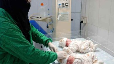 مستشفى أحور العام ينجح في ولادة توأم إناث بعملية قيصرية طارئة ويواصل تسجيل إنجازاته الطبية