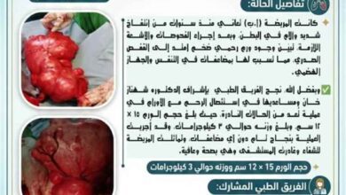نجاح طبي جديد في المستشفى الجامعي لطب النساء والولادة والأطفال