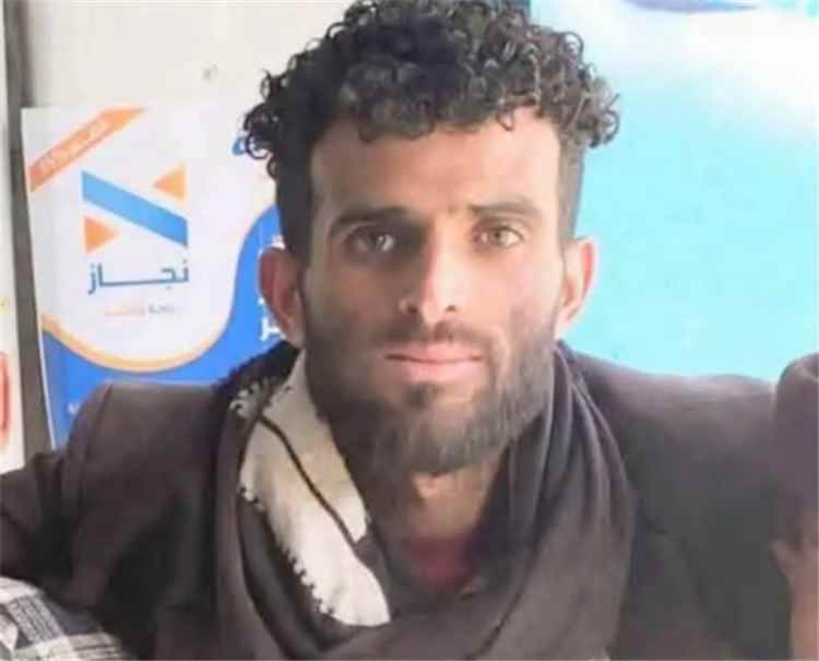 وفاة شاب تحت التعذيب في إب.. والجريمة تثير غضبًا واسعًا