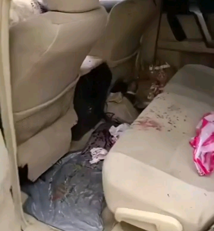 إصابة 3 مدنيين في الضالع بينهم امرأة في قصف حوثي استهدف سيارتي ركاب قادمة من صنعاء