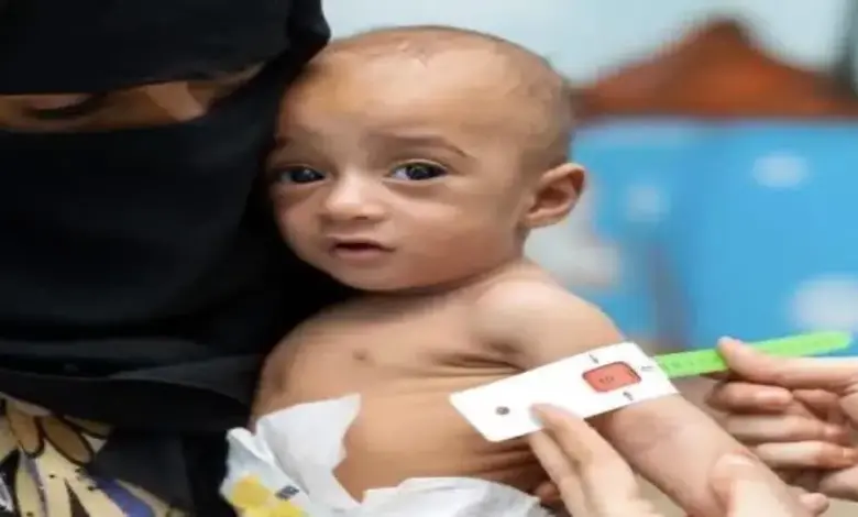 ابتزاز بأسلحة البيولوجيا.. مليشيا الحوثي ترفض لقاحات منقذة لمليون طفل وتطرح شروط تعجيزيه وتصعد ضد المنظمات الدولية