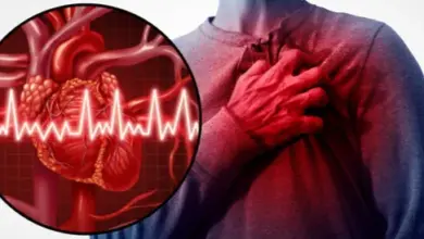 «النمر»: نصف الجلطات القلبية تقع دون محفز واضح والغضب أبرز المسببات