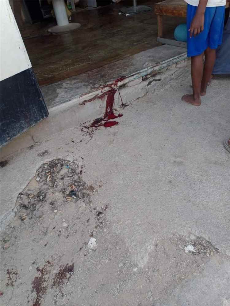 قتلى و جرحى في اشتباكات قبلية بمدينة الشحر