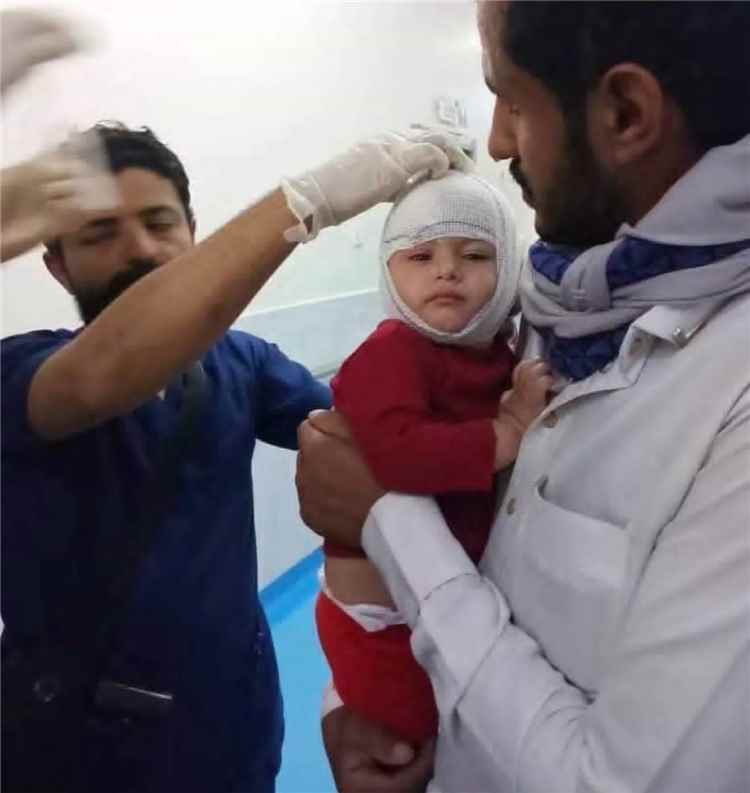 وزير الصحة يعلن حصيلة ضحايا القصف الحوثي على مأرب: شهيدان و14 جريحًا