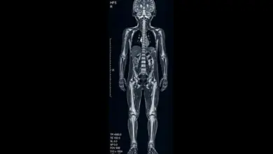 تجمع الطائف الصحي يفعّل فحص الرنين المغناطيسي لكامل الجسم للأطفال