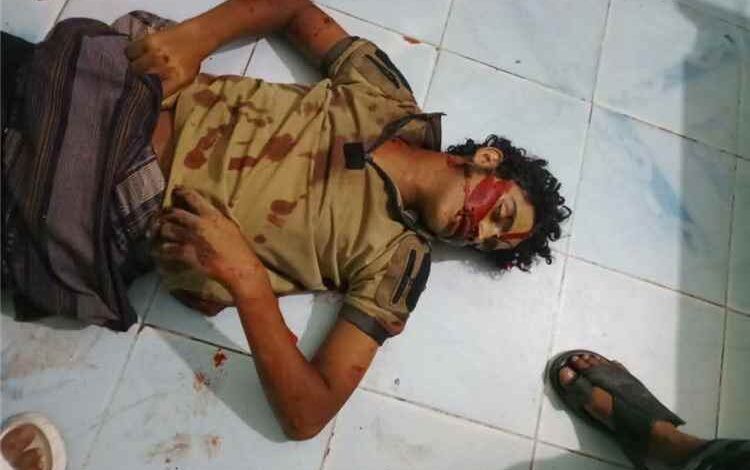 عاجل | مقتل شخصين وإصابة ثالث في مدينة الضالع