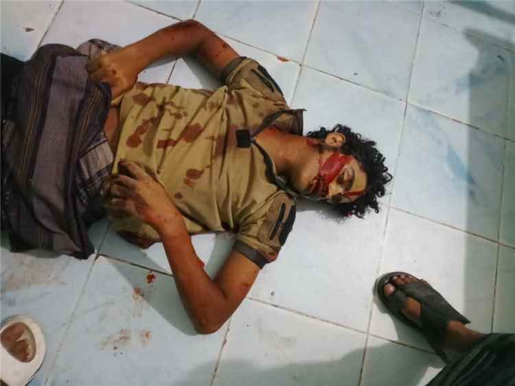 عاجل | مقتل شخصين وإصابة ثالث في مدينة الضالع