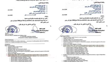 نداء إنساني عاجل لإنقاذ طفلتين من الصمم الكلي في مديرية سرار بأبين